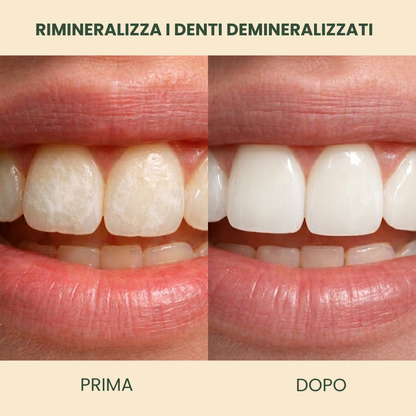 Holariss Chewing Gum Rimineralizzante (Cannella)